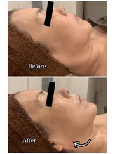 ブランシュール/小顔タイト×24金ジェリーマスク