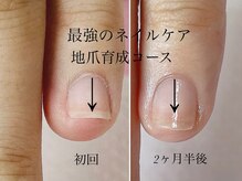 トゥインクリーネイルサロン(Twinkly Nail Salon)/【最強のネイルケア】1回お試し