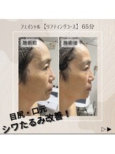 きれい塾 恵比寿/施術前後の変化