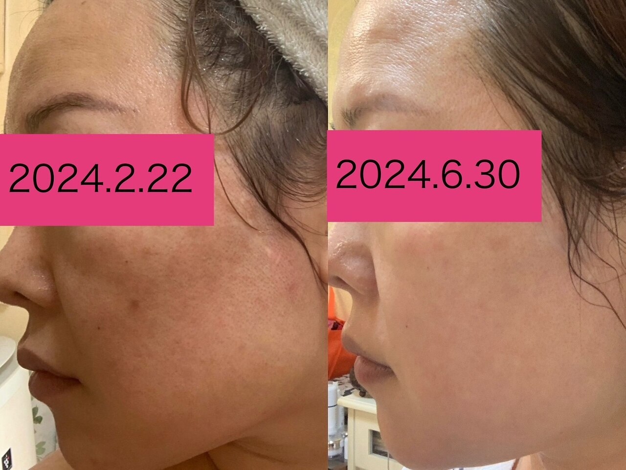 第1印象120%UP!!全ての肌悩みに】韓国式スキンケアで輝く美肌を手に