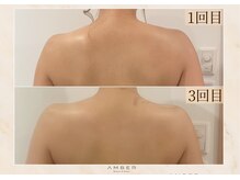 アンバー 恵比寿(AMBER)/ドレスが映える後ろ姿に☆