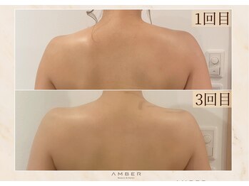 アンバー 恵比寿(AMBER)/ドレスが映える後ろ姿に☆