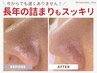 《2回目以降》★人気No1★角栓除去×ハーブピーリング　¥24300→¥19500