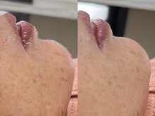 ソルシエール キレイ(ソルシエールkirei)/【人気No.2】本格エステお顔そり