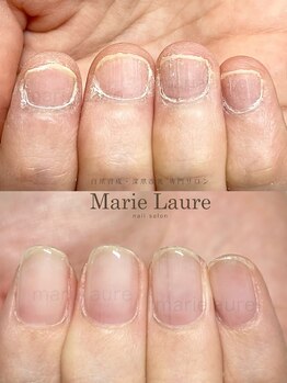 マリーロール 天王寺店(Marie Laure)/深爪矯正/自爪育成/ネイルケア
