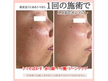 エーワイ(Ay)の雰囲気（シミだけじゃ無い！！お肌の根本から美しく☆）