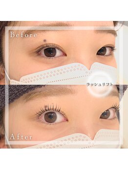 アリゼ(Alize)/ラッシュリフト