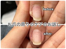 ネイルサロン イツキ(itsuki)/お爪の周りのケアのお話し