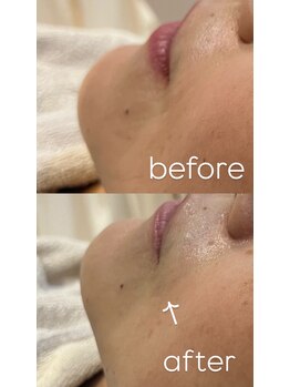 ヴィディトゥ(vidyto)/ENVIRON【エイジングケア】