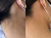 テラス(Terrace)の雰囲気（うなじワックス）