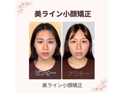 プレシャス(PRECIOUS)の写真