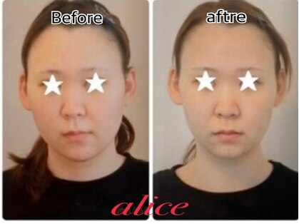 アリス(alice)の写真