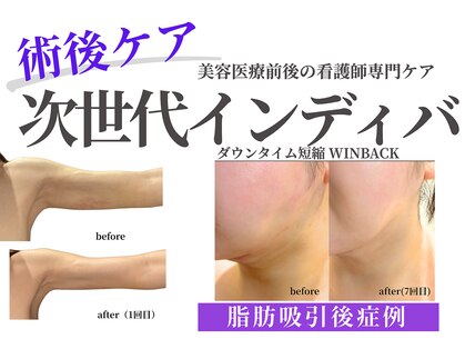 ノーブルノアール(Noble noir)の写真