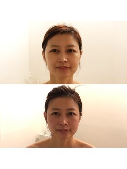 ニューミー スパ(newme spa)の写真/スッキリ小顔矯正！！