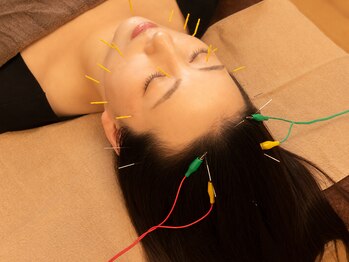 クオーレ(Cuore)の写真/たるみが気になる方に!!インディバフェイシャルでむくみを改善し小顔リフトアップ♪術後ケアにも大人気☆