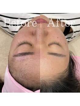 ファミーユ 太田(Fameu)/facial wax