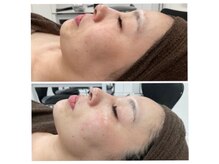 ミー(美mee)の雰囲気（リアボーテ正規取扱店★カウンセリングを大切に理想なお肌へ～）