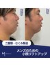 【二重あご×美肌】　リフトアップして美肌ケアが可能◎メンズリフトアップ