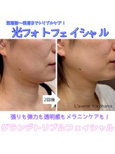 ラブニール 横浜店/光エステフェイシャル