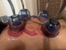 ビューティコア 二子玉川/深部の筋肉疲労をデトックス