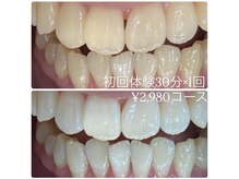 ホワイトニングルーム 横浜店(Whitening Room)/セルフホワイトニング/横浜