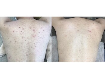 スリリアン 銀座/★お客さまビフォーアフター★