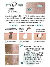 ジェンヌ(jenne.)/ツルツル毛穴に！