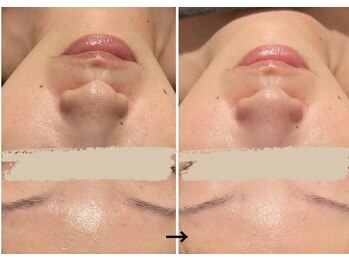 サロン テン(salon TEN)/ツヤっと、もちっと