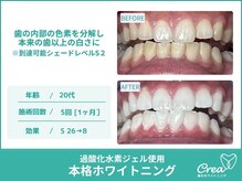 クレア(Crea)/【ホワイトニング症例写真】