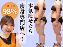 ヨサパーク 美 キレイ(YOSA PARK 美 Kirei)