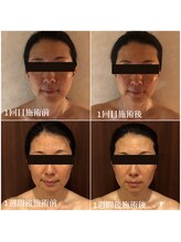 クイーン アンド プリンセス(Queen&Princess)/フェイシャルがすごい！