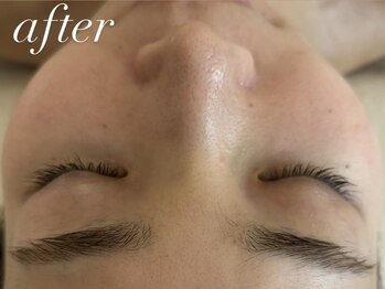 フォー(For...)/ララピール◇韓国肌管理