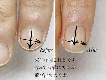 トゥインクリーネイルサロン(Twinkly Nail Salon)/【最強のネイルケア】1回お試し
