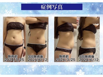 シュシュ(CHUCHU)の写真