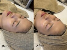 リフコウベ(LIF KOBE)/季節の変わり目の肌荒れにはコレ