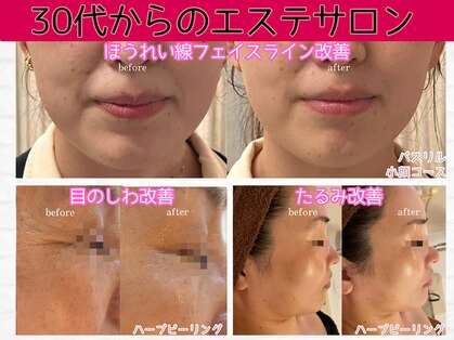 ブランリス 京都店(Blanclis)の写真