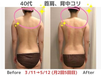 マテリアル(MATERIAL)/首肩スッキリ長く激変！