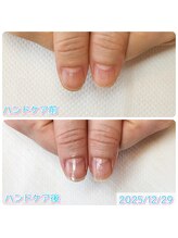 ちひろのへや/スペシャルハンドケア