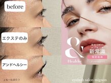 ミニョン(mignon)/アンドヘルシー