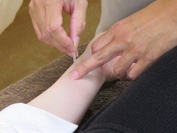 CA鍼灸整骨院/鍼灸施術