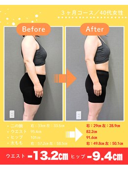 はま美容整体院/40代女性 3ヶ月の結果!