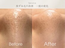 フェイシャルサロン ベルダ(BELDA)の雰囲気（毛穴吸引/マイクロニードル/スクライバー/ピーリング/水玉リフト）