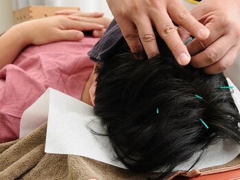 おちあい鍼灸整骨院の写真/【はじめての鍼灸にも】顧客様からの支持◎歴20年以上の国家資格者によるオーダーメイド施術！