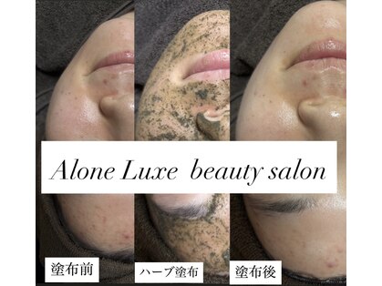 アローネリュクス(Alone Luxe)の写真