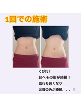 ベイス(BASE)/【20代/大学生/やせたい】