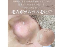 お肌が綺麗になるとお友達に褒められ肌！喜ばれるお客様多数！！