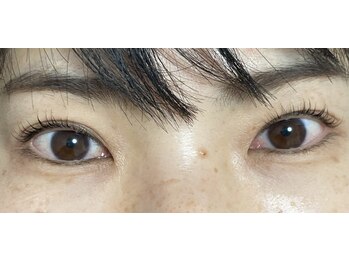 シスタス(Cistus)/ダメージレスラッシュリフト