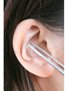 アロエ(Aloe)/耳ツボ施術