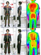 姫路なごみ整体院 なごみ鍼灸院/改善例（右尻と右下肢の痛み）