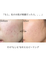 ラプア(Lapua)/全世代の肌トラブルにアプローチ